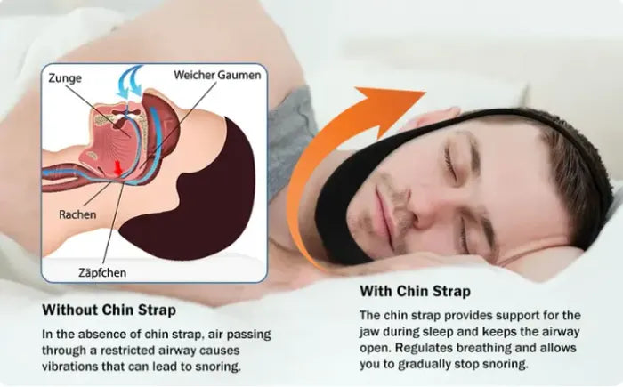 💥AirFlow Jaw Strap💥